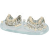 Studienmodell Demo Implant C&B - Ersatzset 11-teilig - 355639
