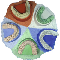 Base Kő folyékony - zsák 5 kg bázis kő mélykék