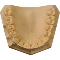 UltiRock - Karton 15 kg Gips golden brown