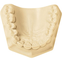 UltiRock - Karton 15 kg Gips ivory