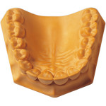 Super Die - Karton 15 kg Superhartgips gelb