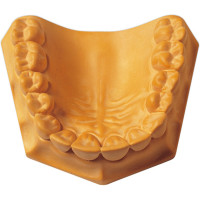 Super Die - Karton 15 kg Superhartgips gelb