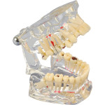 Studienmodell Transparent De Luxe - 1 db, átlátszó - 355642