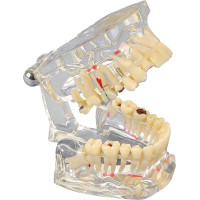 Studienmodell Transparent De Luxe - 1 db, átlátszó - 355642