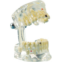 Studienmodell Transparent Kind - 1 db, alsó und felső mit zehn Milchzähnen, átlátszó - 355643
