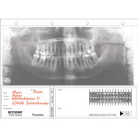 Panostar, (30 x 12 cm), Röntgenfilm-tasak, 100 darab