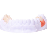 FREEPRINT® gingiva  500 g UV